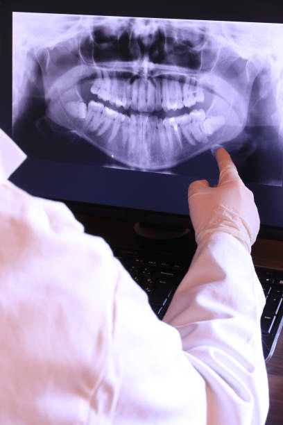Best Emergency Tooth Extraction in Palmyra, MO